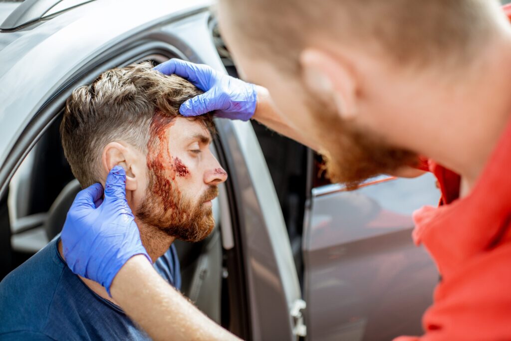 Lesiones en la cabeza tras un accidente de tráfico
